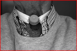 person with a trachea